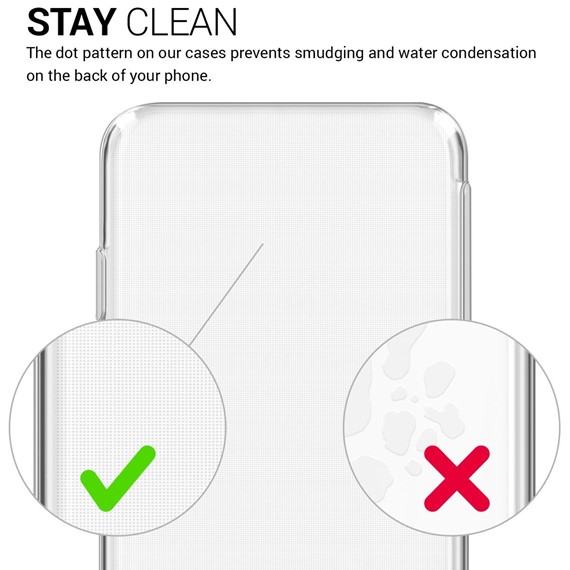 Microsonic Xiaomi Mi 5X Kılıf Transparent Soft Beyaz 3
