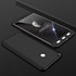 Microsonic Xiaomi Mi Max 2 Kılıf Double Dip 360 Protective Siyah 3