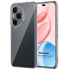 Microsonic Honor 400 Pro Kılıf Transparent Soft Şeffaf