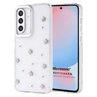 Microsonic Samsung Galaxy A56 Kılıf PrettyCharm Star