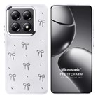 Microsonic Xiaomi Mi 14T Pro Kılıf PrettyCharm Bow