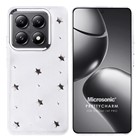 Microsonic Xiaomi Mi 14T Pro Kılıf PrettyCharm Star
