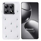 Microsonic Xiaomi Mi 14T Pro Kılıf PrettyCharm Tulip