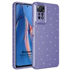 Microsonic Xiaomi Redmi Note 11 Pro 5G Kılıf Grand Stardust Mor