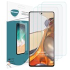 Microsonic Xiaomi Mi 11T Pro Screen Protector Nano Glass Cam Ekran Koruyucu 3 lü Paket