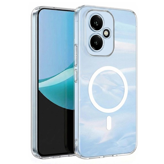 Microsonic Honor 400 Kılıf MagSafe Clear Sararmaz Şeffaf 1