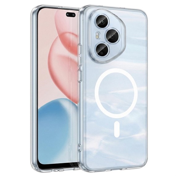 Microsonic Honor 400 Pro Kılıf MagSafe Clear Sararmaz Şeffaf 1