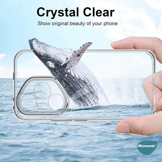 Microsonic Honor 400 Pro Kılıf Transparent Soft Şeffaf 2