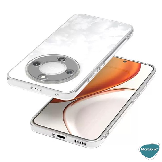 Microsonic Honor Magic 8 Lite Kılıf Transparent Soft Şeffaf 4