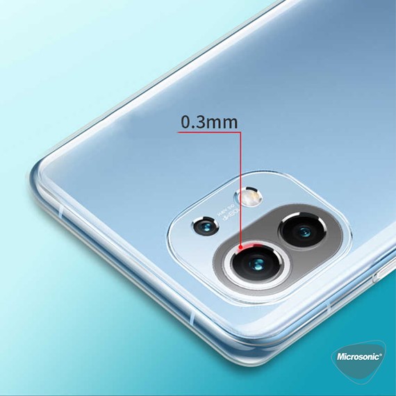 Microsonic Xiaomi Mi 11 Lite Kılıf Transparent Soft Beyaz 4