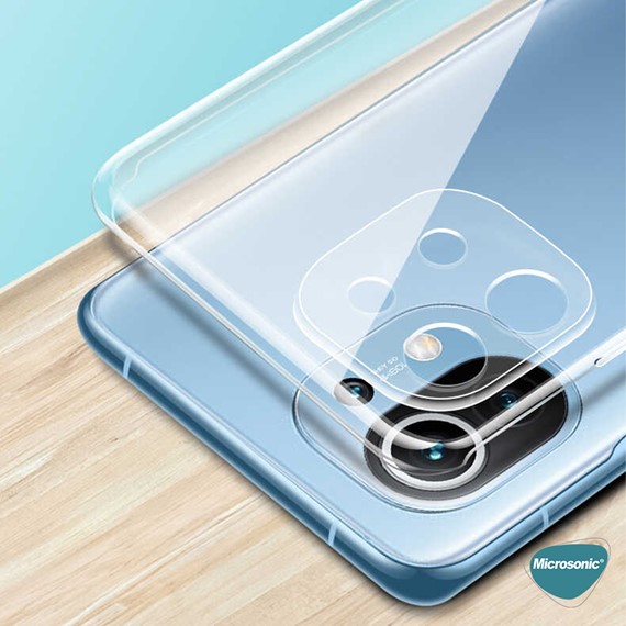 Microsonic Xiaomi Mi 11 Lite Kılıf Transparent Soft Beyaz 7