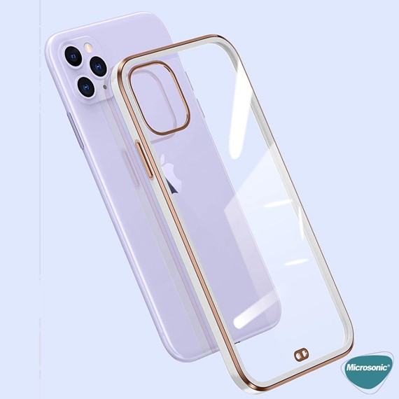 Microsonic Apple iPhone X Kılıf Laser Plated Soft Siyah 7