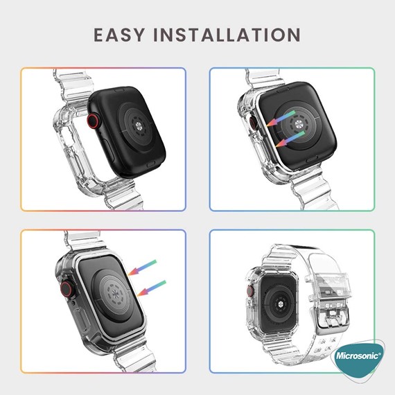 Microsonic Apple Watch Series 10 46mm Kordon Transparent Clear Band Siyah 4