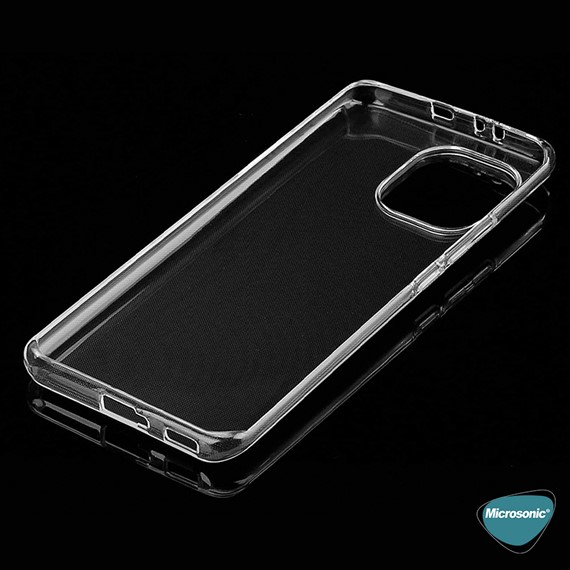 Microsonic Xiaomi Mi 11 Kılıf Transparent Soft Beyaz 4