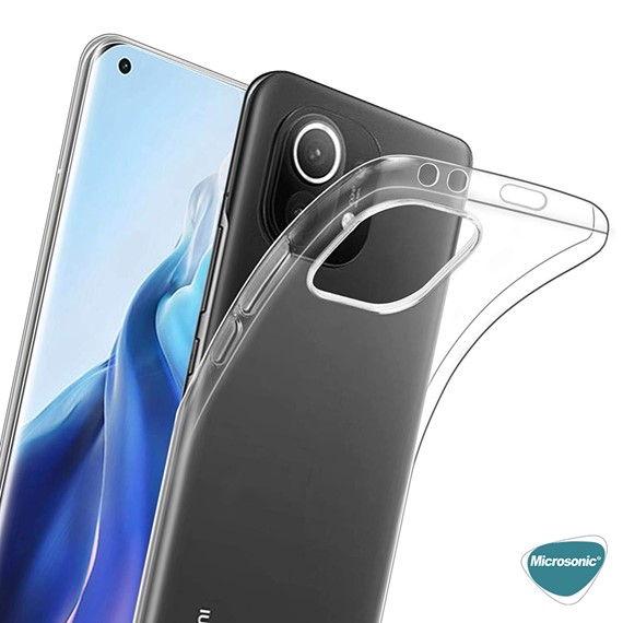 Microsonic Xiaomi Mi 11 Kılıf Transparent Soft Beyaz 6