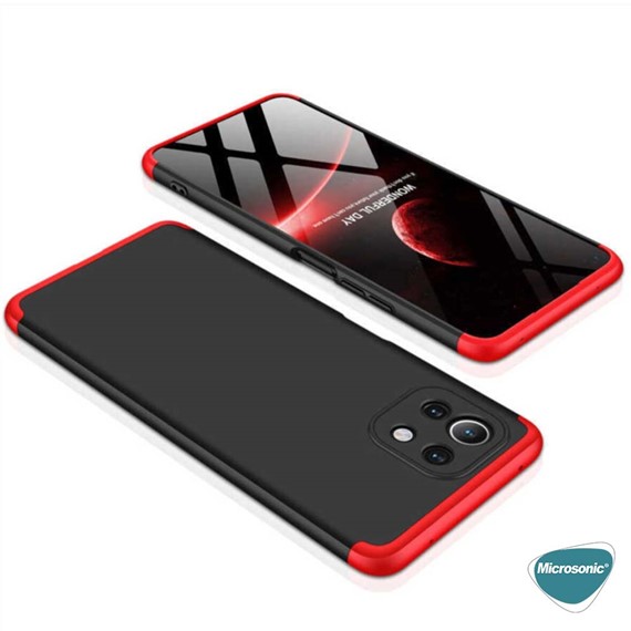 Microsonic Xiaomi Mi 11 Lite Kılıf Double Dip 360 Protective Siyah Gri 4