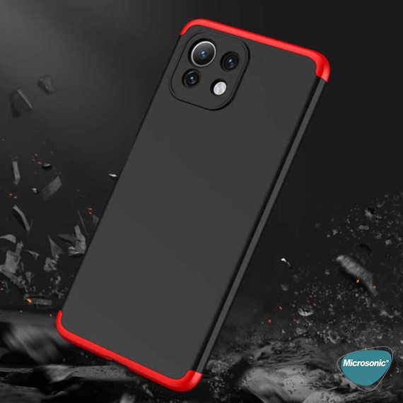 Microsonic Xiaomi Mi 11 Lite Kılıf Double Dip 360 Protective Siyah Mavi 6