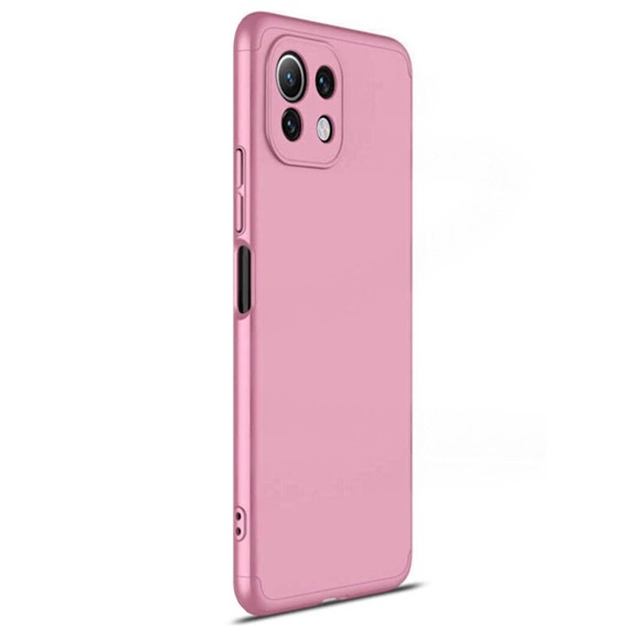 Microsonic Xiaomi Mi 11 Lite Kılıf Double Dip 360 Protective Rose Gold 2