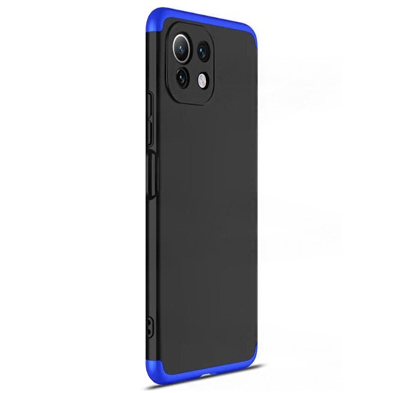 Microsonic Xiaomi Mi 11 Lite Kılıf Double Dip 360 Protective Siyah Mavi 2