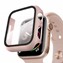 Microsonic Apple Watch Series 1 38mm Kılıf Matte Premium Slim WatchBand Rose Gold