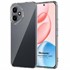 Microsonic Honor 400 Kılıf Transparent Soft Şeffaf 1