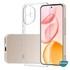 Microsonic Honor 400 Kılıf Transparent Soft Şeffaf 4