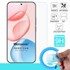 Microsonic Honor 400 Nano Glass Cam Ekran Koruyucu 2