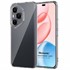 Microsonic Honor 400 Pro Kılıf Transparent Soft Şeffaf 1