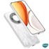 Microsonic Honor Magic 8 Lite Kılıf Transparent Soft Şeffaf 3