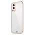Microsonic OnePlus Nord 2 Kılıf Laser Plated Soft Beyaz 2