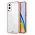 Microsonic OnePlus Nord 2 Kılıf Laser Plated Soft Pembe 1