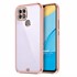 Microsonic Oppo A15s Kılıf Laser Plated Soft Pembe 1