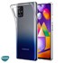 Microsonic Samsung Galaxy M31s Kılıf Transparent Soft Beyaz 5