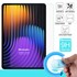 Microsonic Xiaomi Pad 7 Nano Glass Cam Ekran Koruyucu 2