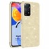 Microsonic Xiaomi Redmi Note 11 Pro 5G Kılıf Sparkle Shiny Gold 1