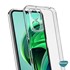 Microsonic Xiaomi Redmi 13C Kılıf Transparent Soft Şeffaf 7