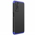 Microsonic Xiaomi Redmi Note 11 Pro 5G Kılıf Double Dip 360 Protective Siyah Mavi 2