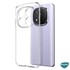Microsonic Xiaomi Redmi Note 15 Pro 5G Kılıf Transparent Soft Şeffaf 2