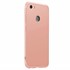 Microsonic Xiaomi Redmi Note 5A Prime Kılıf Double Dip 360 Protective Rose Gold 2