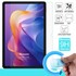 Microsonic Xiaomi Redmi Pad 2 Nano Glass Cam Ekran Koruyucu 2