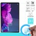 Microsonic Lenovo Tab P11 Plus TB-J616F Nano Glass Cam Ekran Koruyucu 1