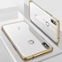 Microsonic Xiaomi Redmi S2 Kılıf Skyfall Transparent Clear Gold 3